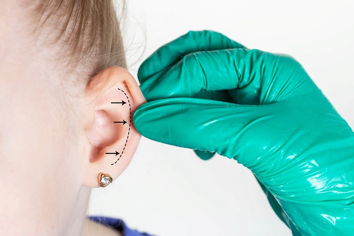 ear surgery