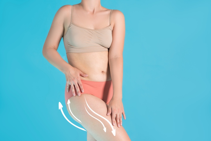 thigh lift surgery